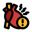 Heart attack
