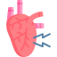 Heart attack