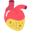 Heart disease