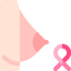 Breast cancer