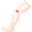 Bones