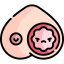 Breast cancer