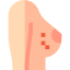 Breast cancer