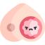 Breast cancer