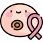 Breast cancer