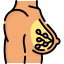 Breast cancer