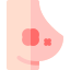 Breast