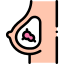 Breast cancer