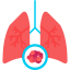 Lung cancer