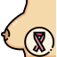 Breast cancer