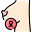 Breast cancer