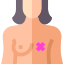 Breast cancer