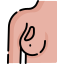 Breast cancer